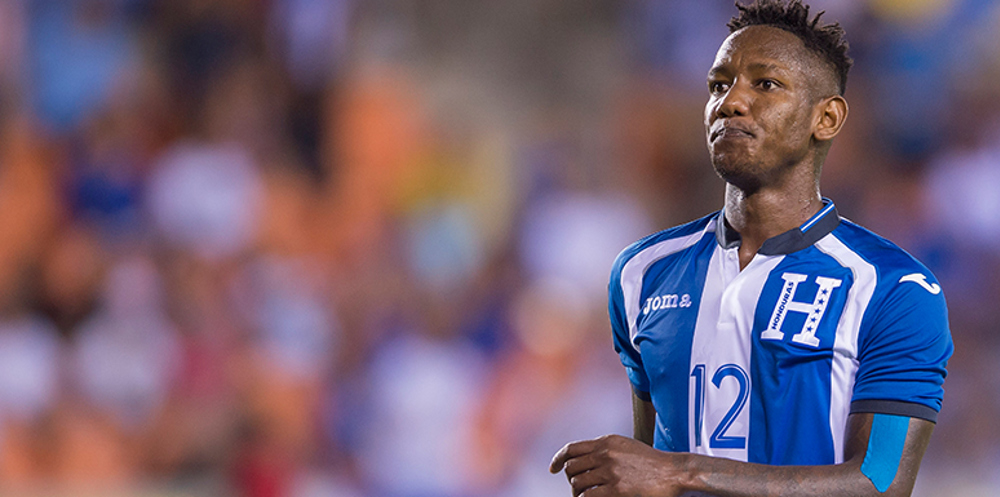 Honduras’ Quioto shakes off injury worry